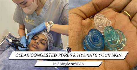 hydrafacial singapore|HydraFacial in Singapore: What It Is & Best Clinics.